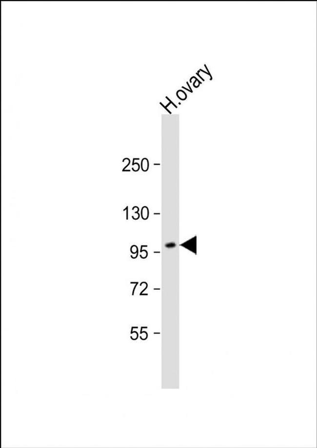 ESPNL Antibody in Western Blot (WB)