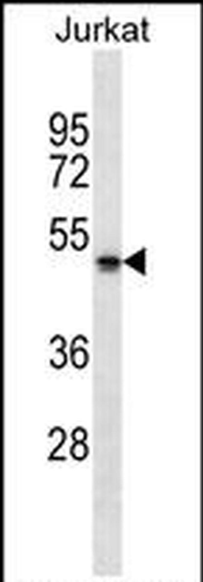 NBPF5P Antibody in Western Blot (WB)