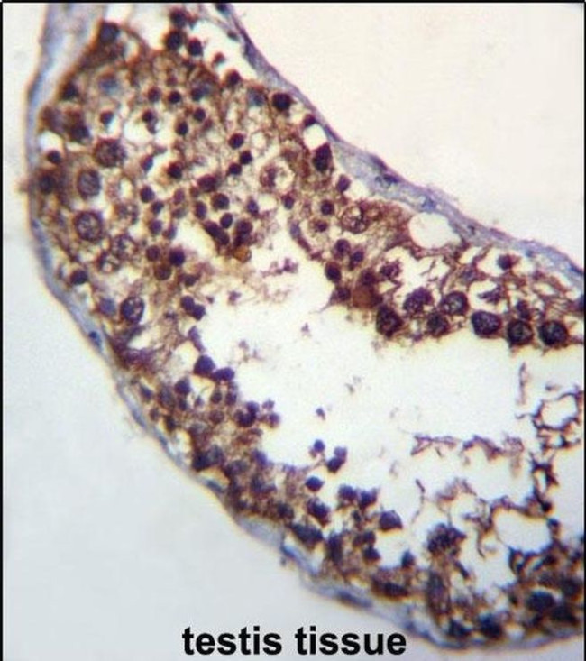 POMT1 Antibody in Immunohistochemistry (IHC)