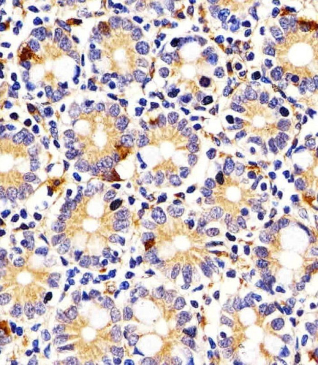 IDO2 Antibody in Immunohistochemistry (IHC)