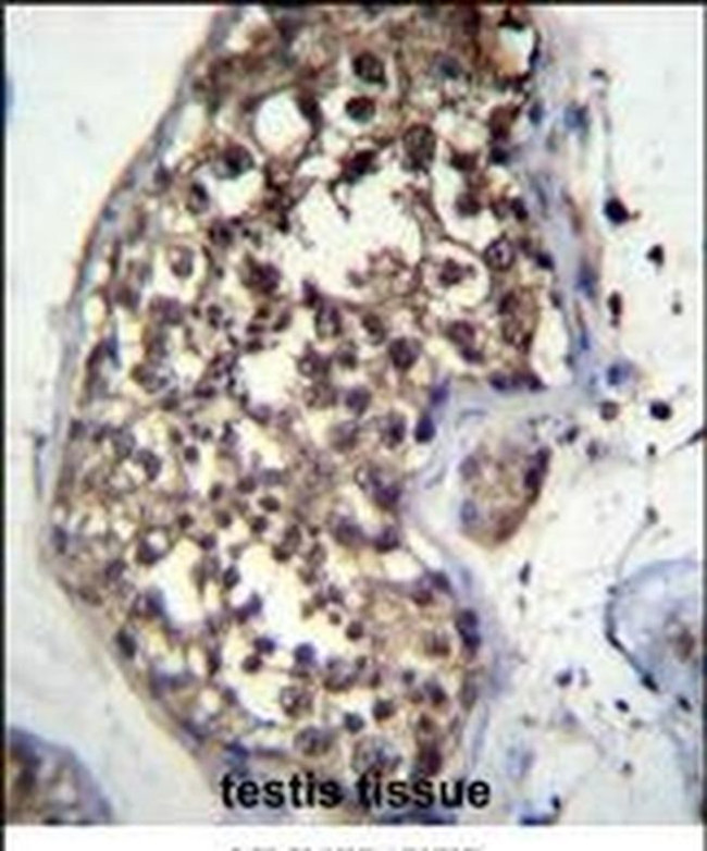 FBXO15 Antibody in Immunohistochemistry (IHC)