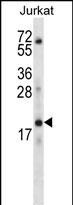KRTAP13-3 Antibody in Western Blot (WB)
