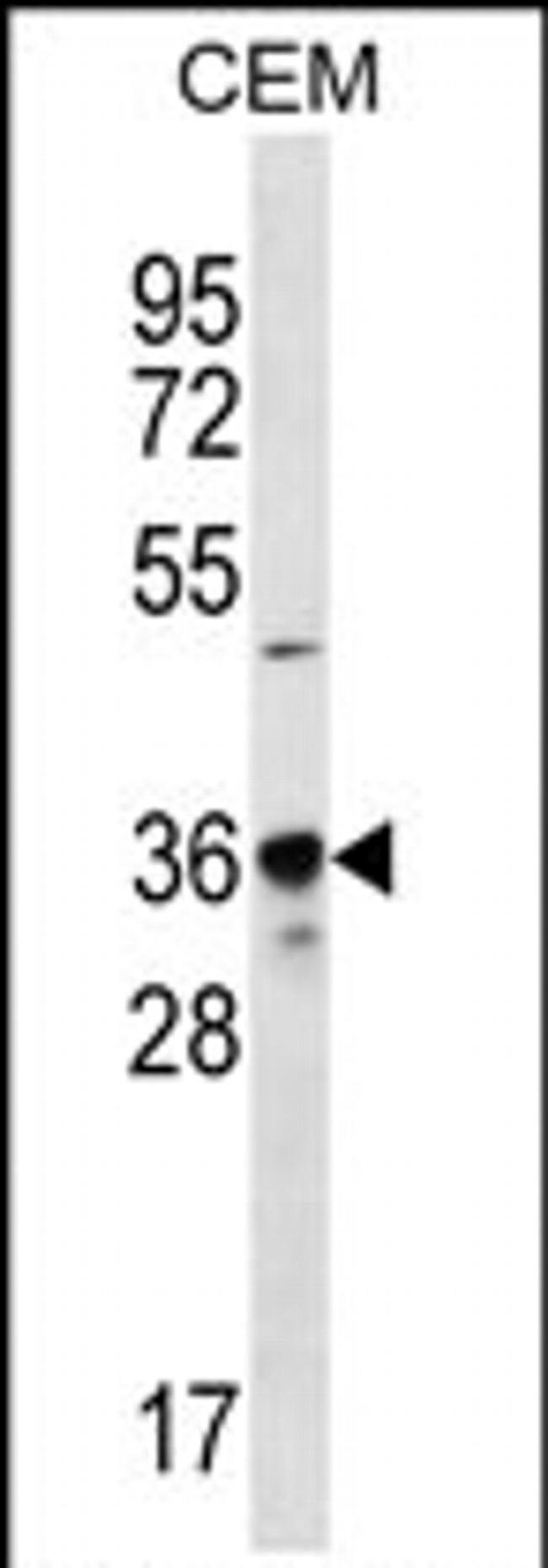 PDC Antibody in Western Blot (WB)
