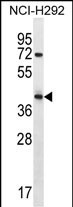 ARRDC5 Antibody in Western Blot (WB)