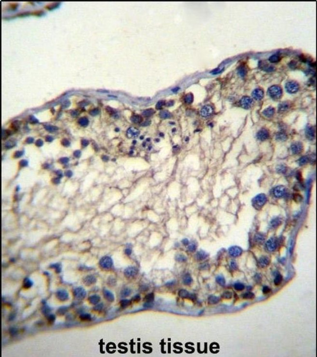TSSK6 Antibody in Immunohistochemistry (IHC)