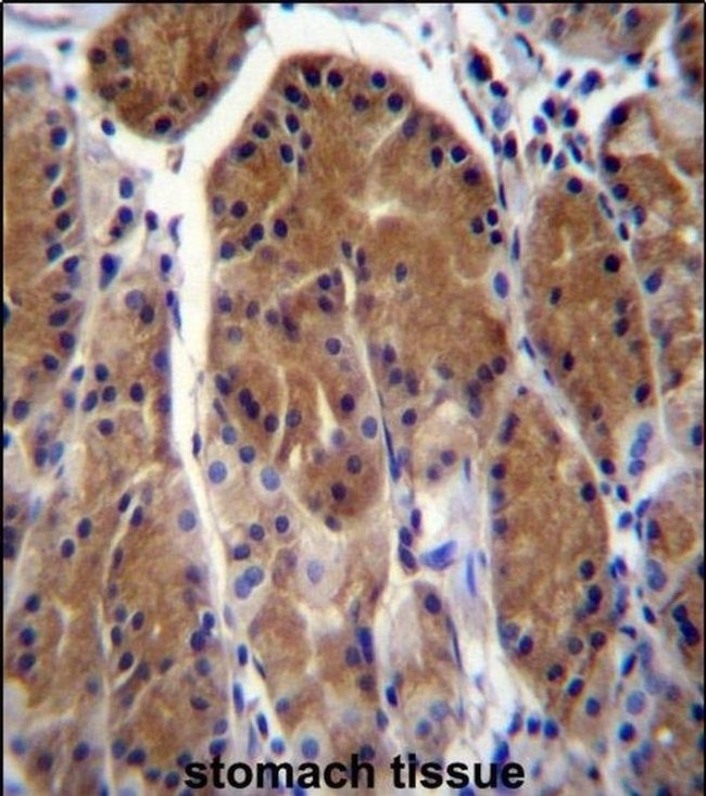 TSSK6 Antibody in Immunohistochemistry (IHC)