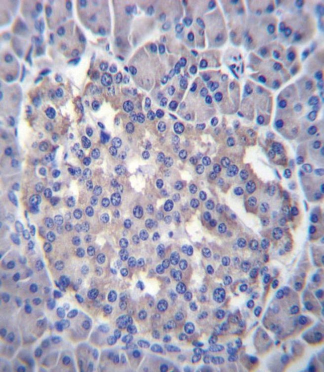 SESN3 Antibody in Immunohistochemistry (IHC)