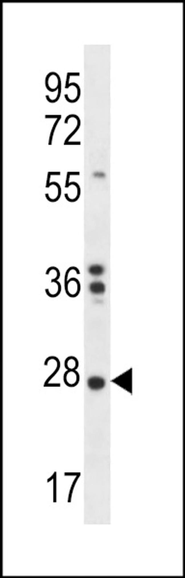 NKAIN1 Antibody in Western Blot (WB)