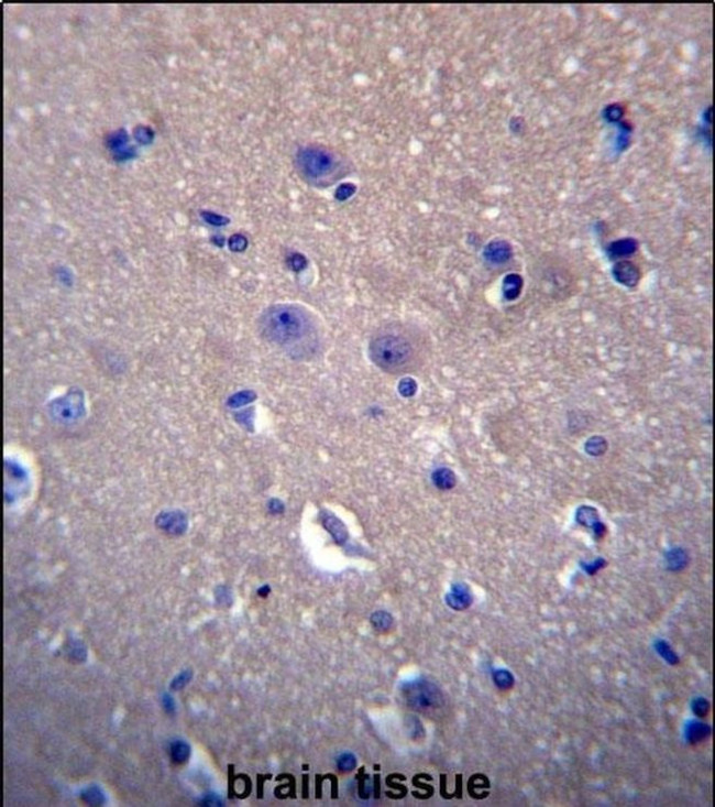 DNAJB6 Antibody in Immunohistochemistry (IHC)