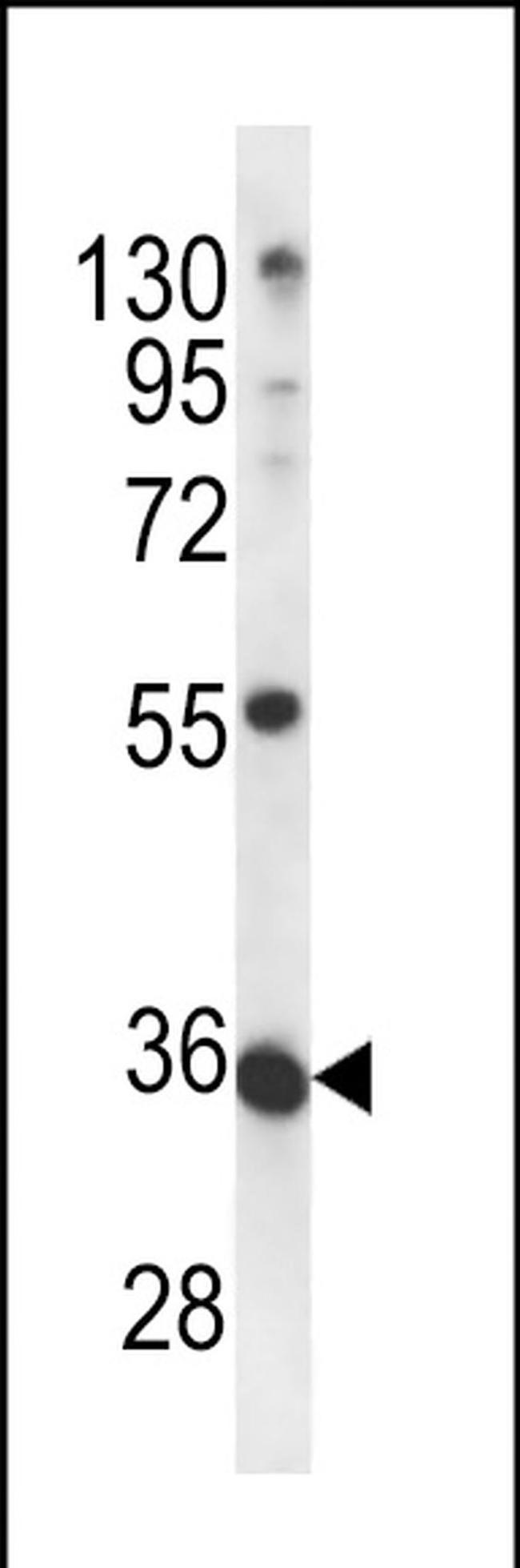 METTL11B Antibody in Western Blot (WB)