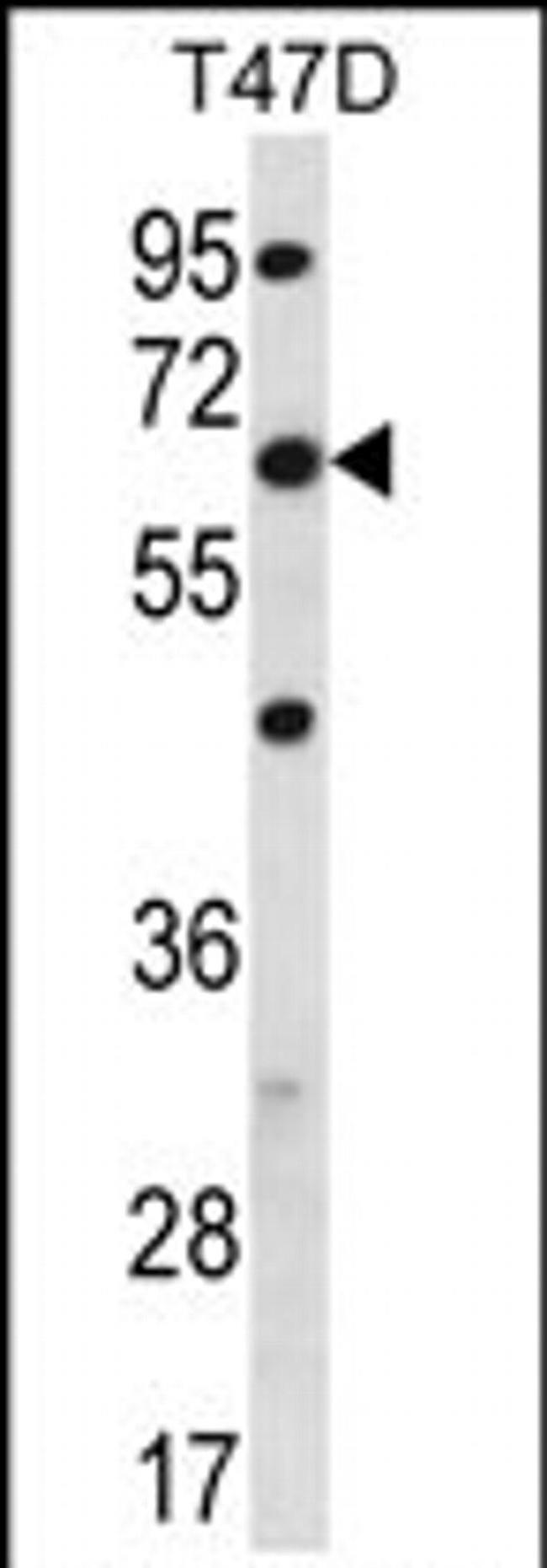 FAM83D Antibody in Western Blot (WB)
