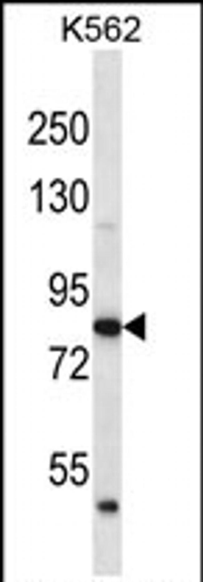 ABTB2 Antibody in Western Blot (WB)