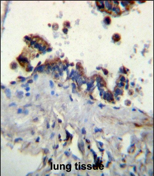 Ficolin 3 Antibody in Immunohistochemistry (Paraffin) (IHC (P))