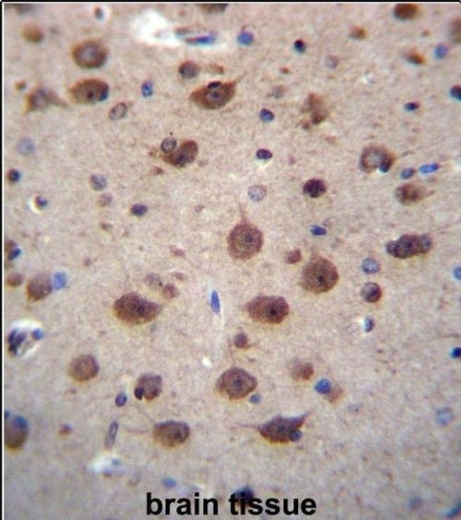 PNKD Antibody in Immunohistochemistry (IHC)