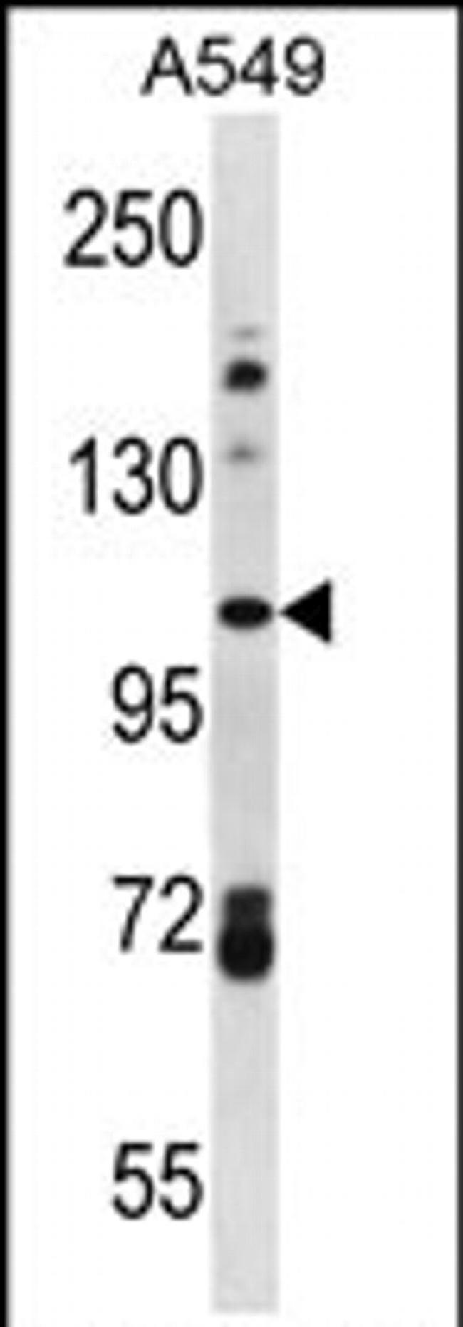 FAM13B Antibody in Western Blot (WB)