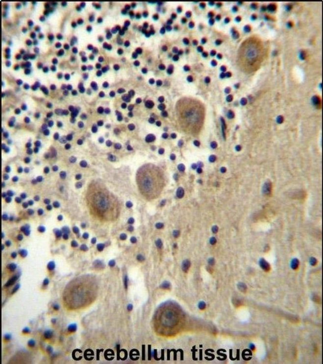 BEND6 Antibody in Immunohistochemistry (IHC)
