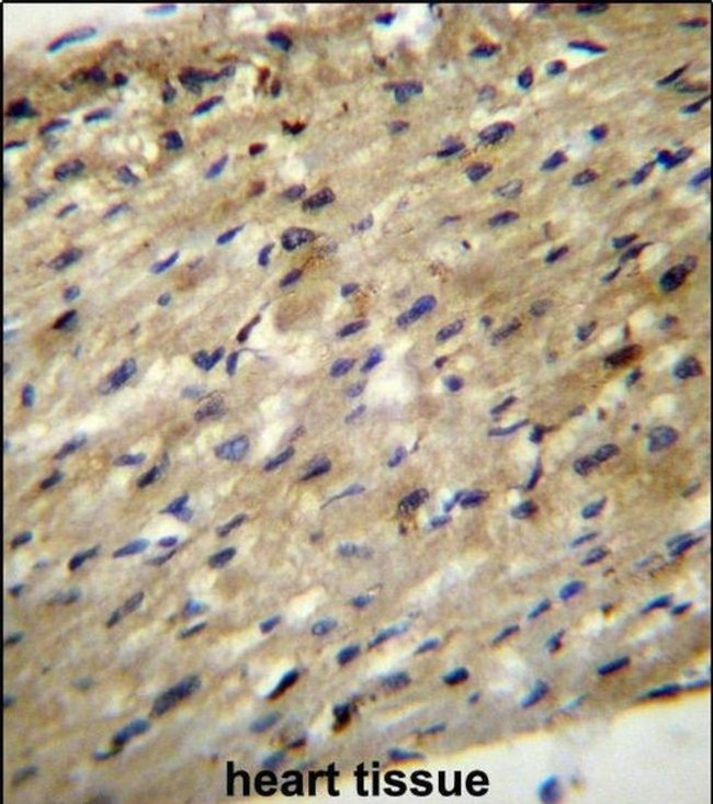 ABCD2 Antibody in Immunohistochemistry (IHC)
