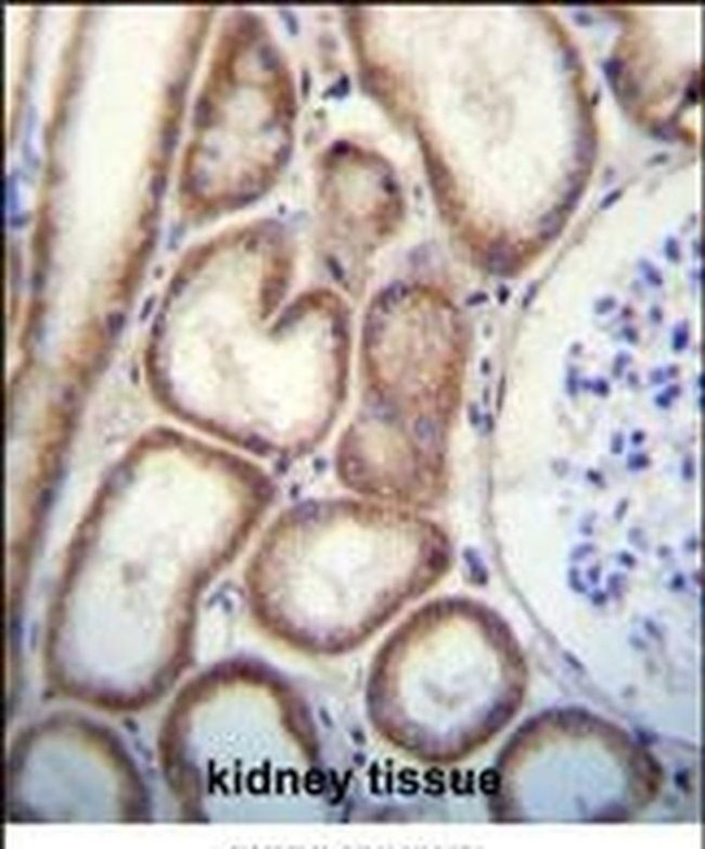 Tetranectin Antibody in Immunohistochemistry (IHC)
