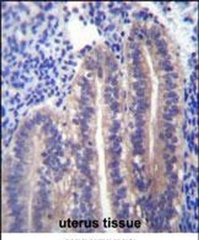 ANGPTL7 Antibody in Immunohistochemistry (IHC)