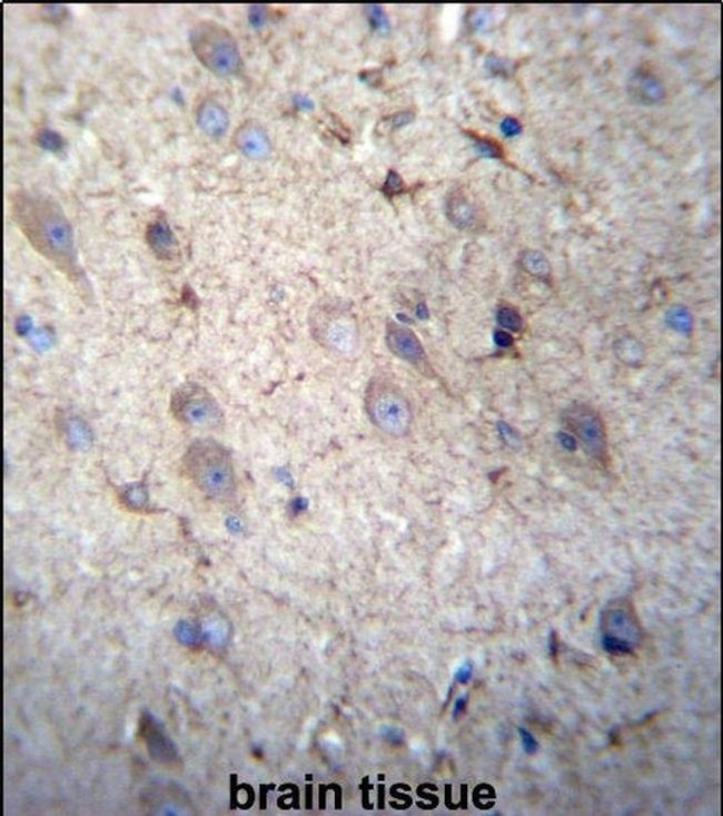 GSTM5 Antibody in Immunohistochemistry (IHC)