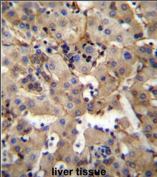 SGPL1 Antibody in Immunohistochemistry (IHC)