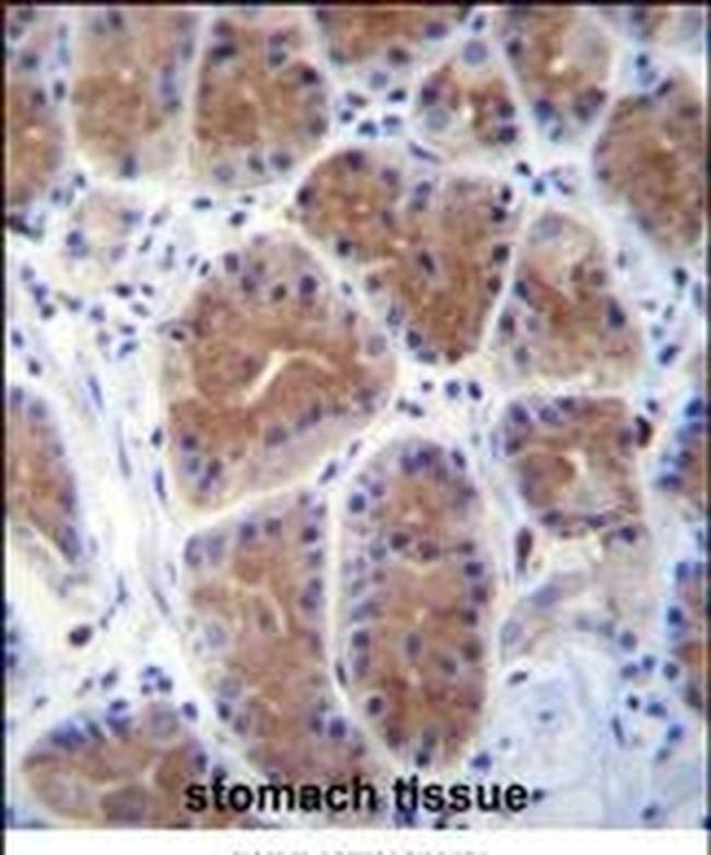 MID1IP1 Antibody in Immunohistochemistry (IHC)