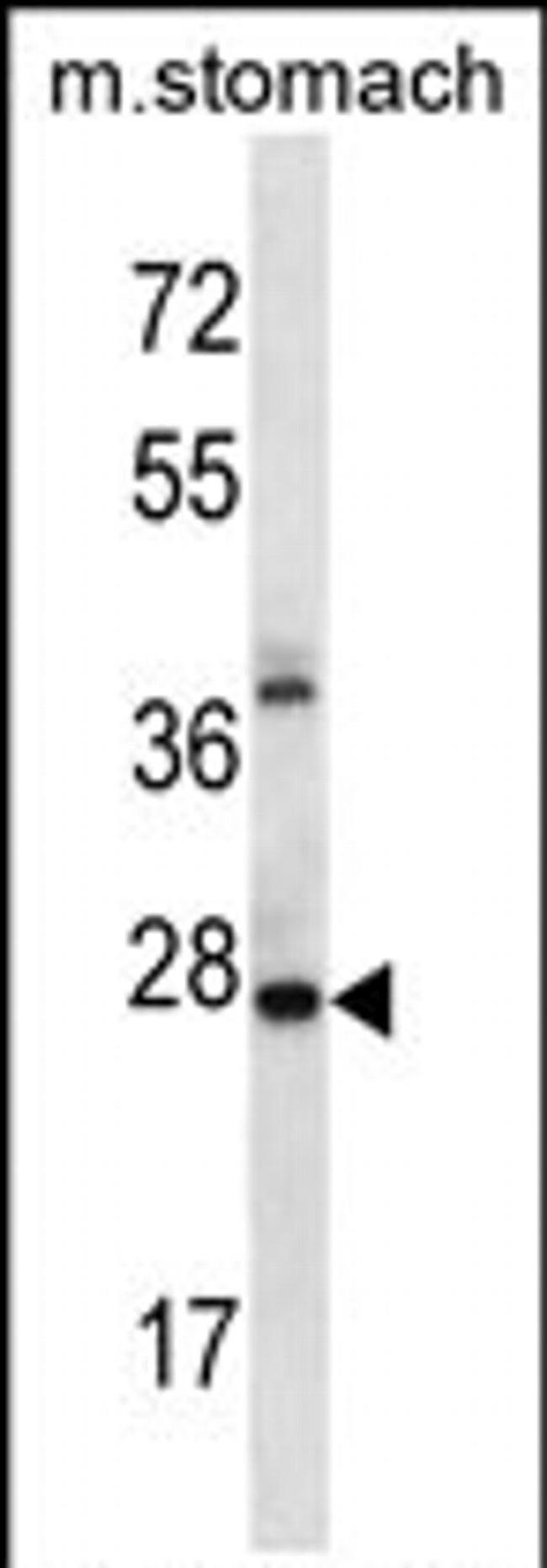 ALKBH4 Antibody in Western Blot (WB)