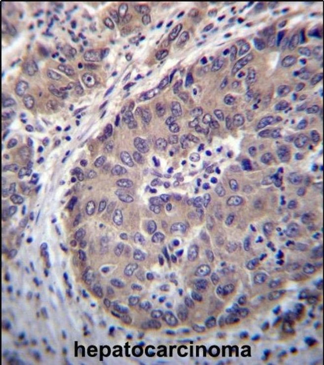 PNLIPRP3 Antibody in Immunohistochemistry (IHC)