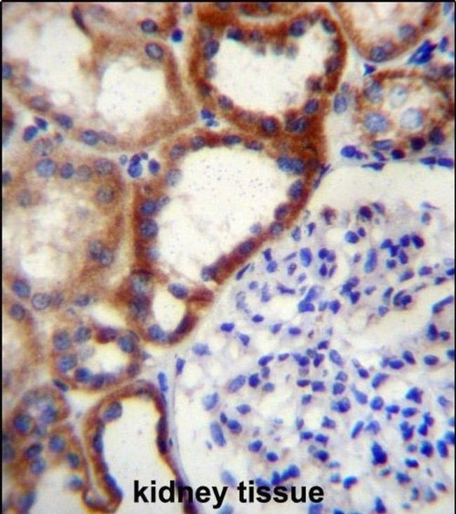 STARD4 Antibody in Immunohistochemistry (IHC)