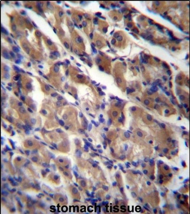 ABRA Antibody in Immunohistochemistry (IHC)