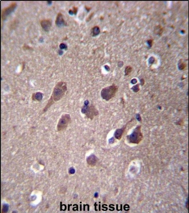 PHACTR3 Antibody in Immunohistochemistry (IHC)