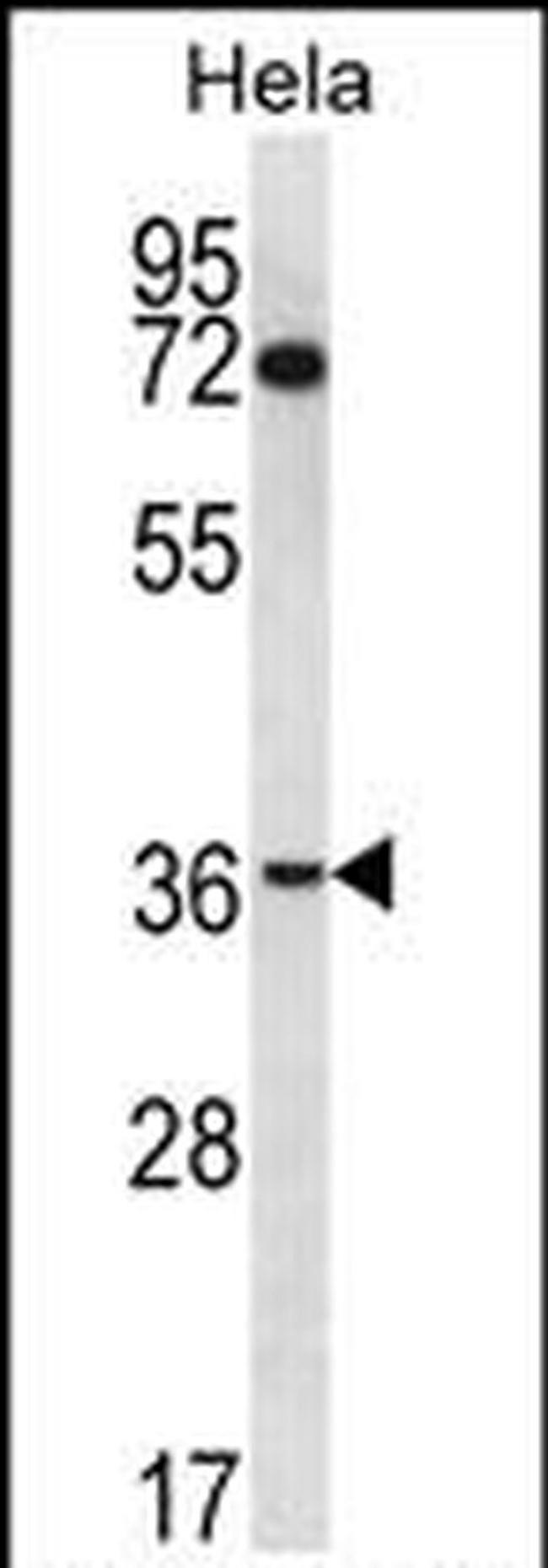 NUP35 Antibody in Western Blot (WB)