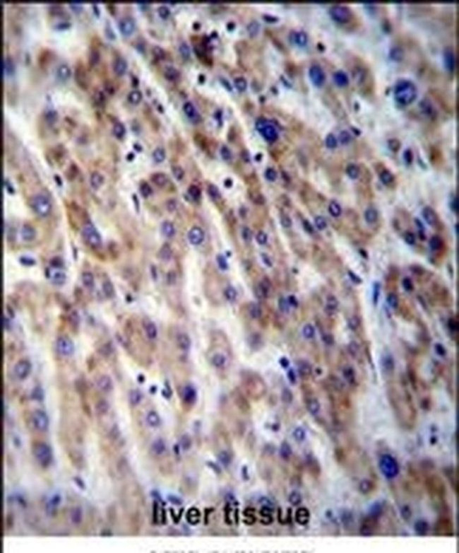 CPN1 Antibody in Immunohistochemistry (IHC)