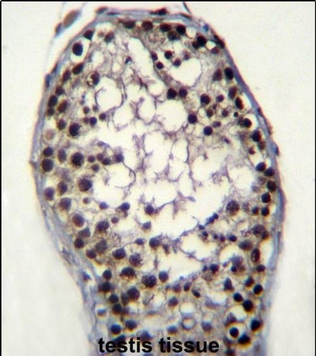 Glycerol kinase Antibody in Immunohistochemistry (IHC)