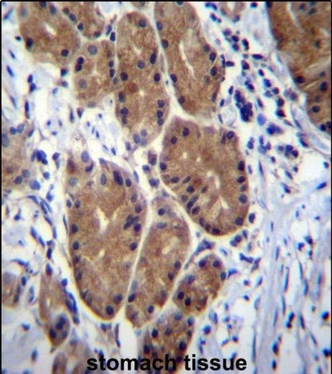 ZCRB1 Antibody in Immunohistochemistry (IHC)