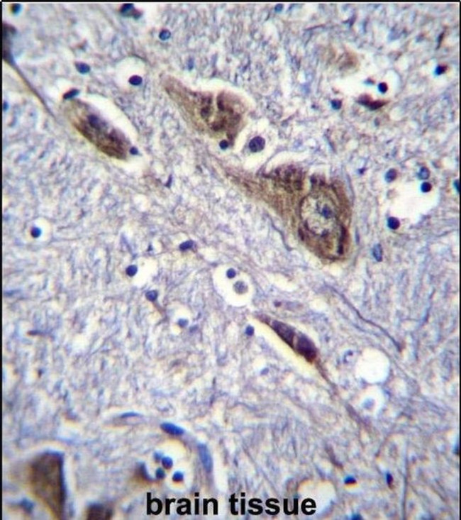 ELAVL2 Antibody in Immunohistochemistry (IHC)