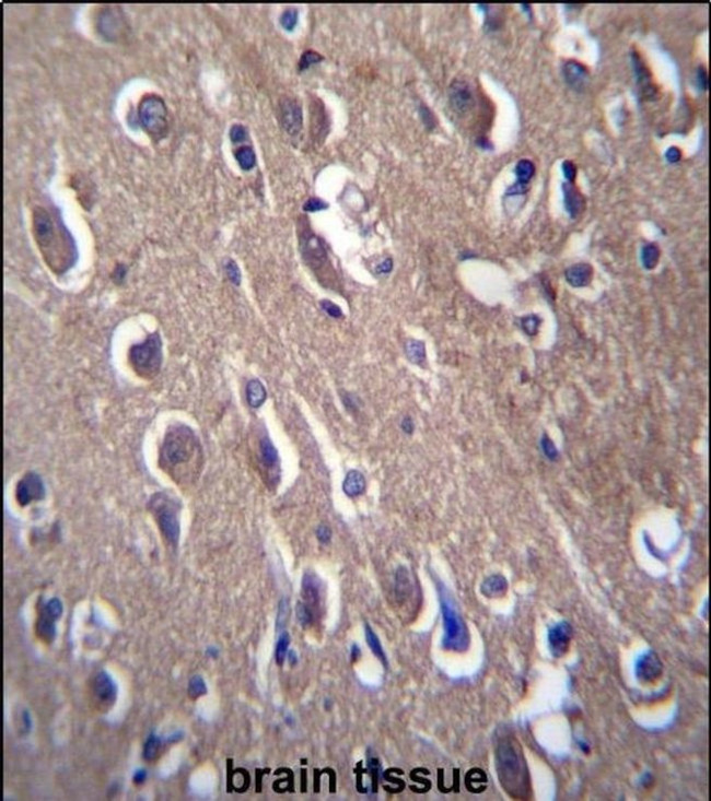 PON2 Antibody in Immunohistochemistry (IHC)