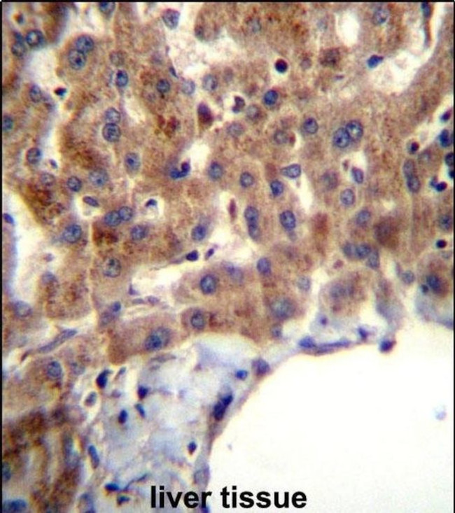 MBNL2 Antibody in Immunohistochemistry (IHC)