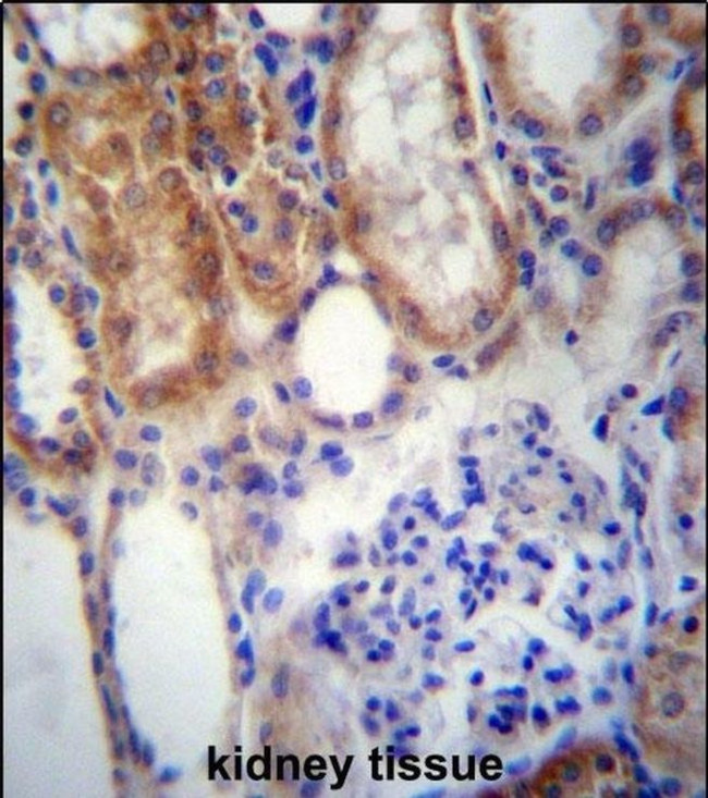SUSD2 Antibody in Immunohistochemistry (IHC)