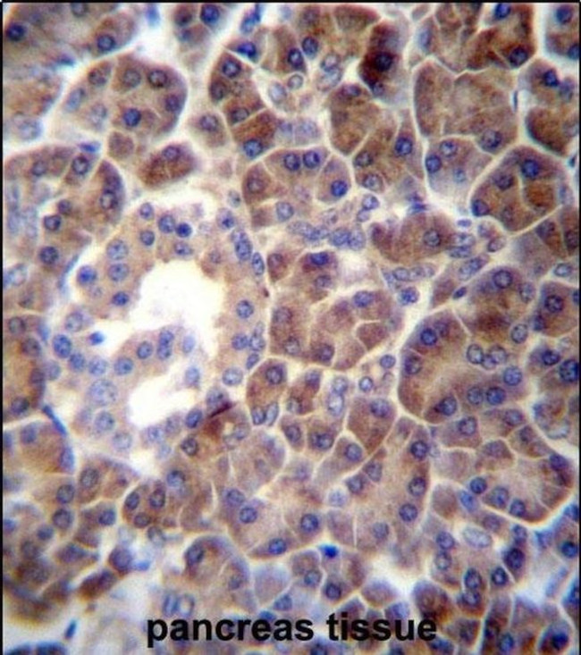PTDSS2 Antibody in Immunohistochemistry (IHC)