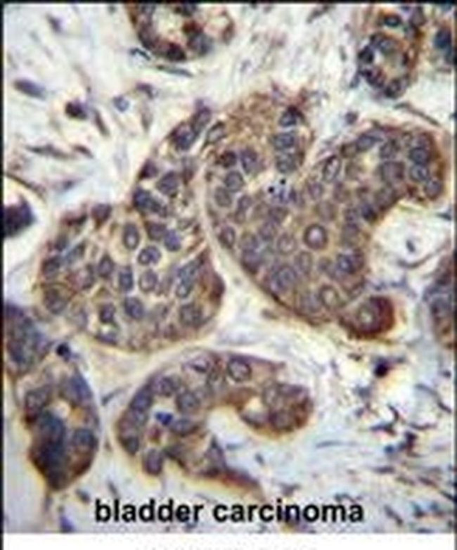 GOLT1B Antibody in Immunohistochemistry (IHC)