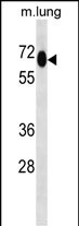 MEPCE Antibody in Western Blot (WB)