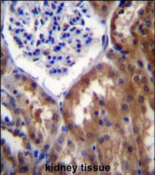 PPP1R15B Antibody in Immunohistochemistry (IHC)