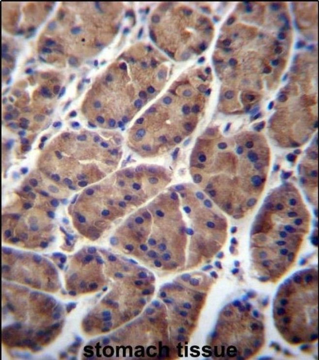 PFDN5 Antibody in Immunohistochemistry (IHC)