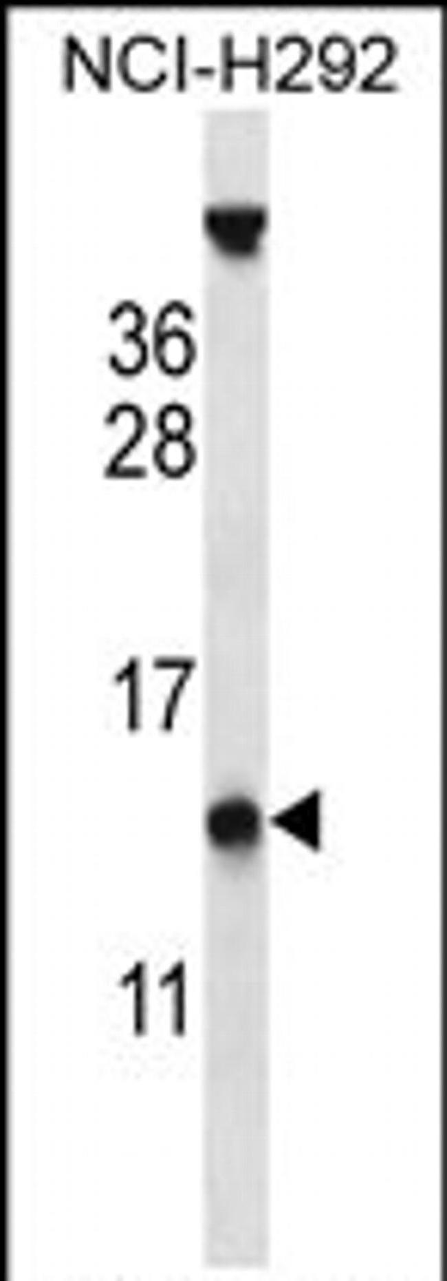 PYDC1 Antibody in Western Blot (WB)