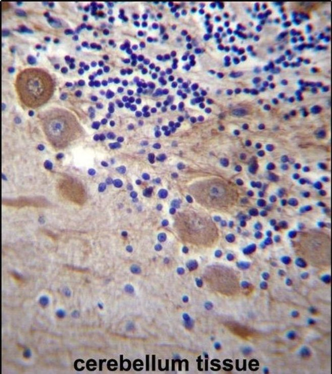 SSR2 Antibody in Immunohistochemistry (IHC)