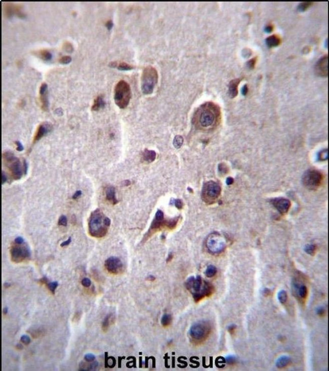TMEM55B Antibody in Immunohistochemistry (IHC)
