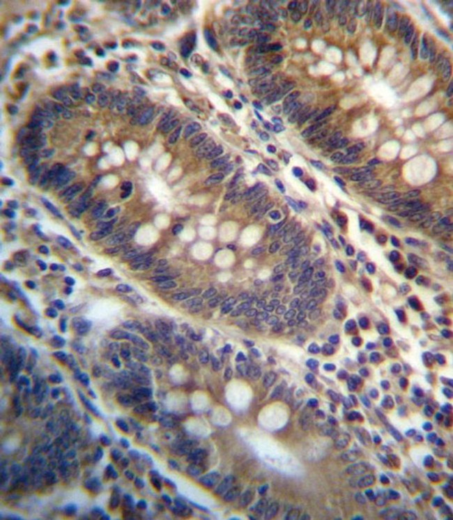 PGAP3 Antibody in Immunohistochemistry (IHC)