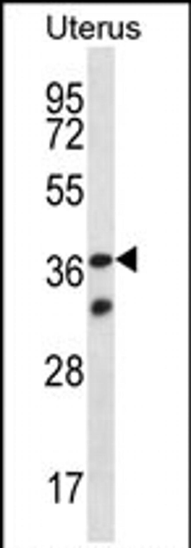 OR4X2 Antibody in Western Blot (WB)