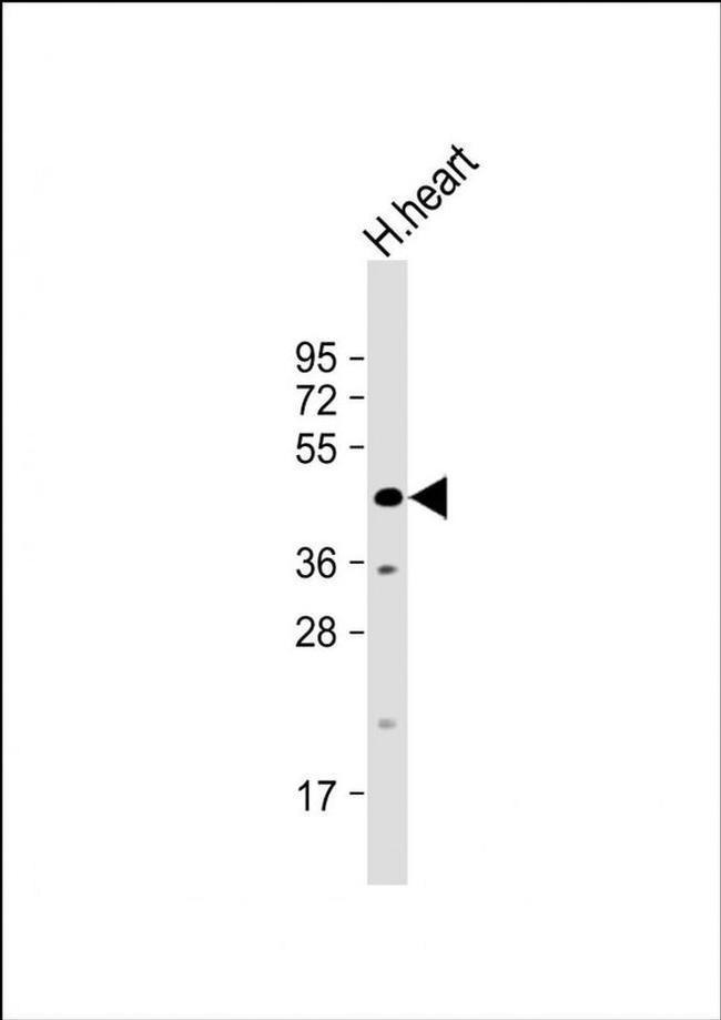 WDR45 Antibody in Western Blot (WB)